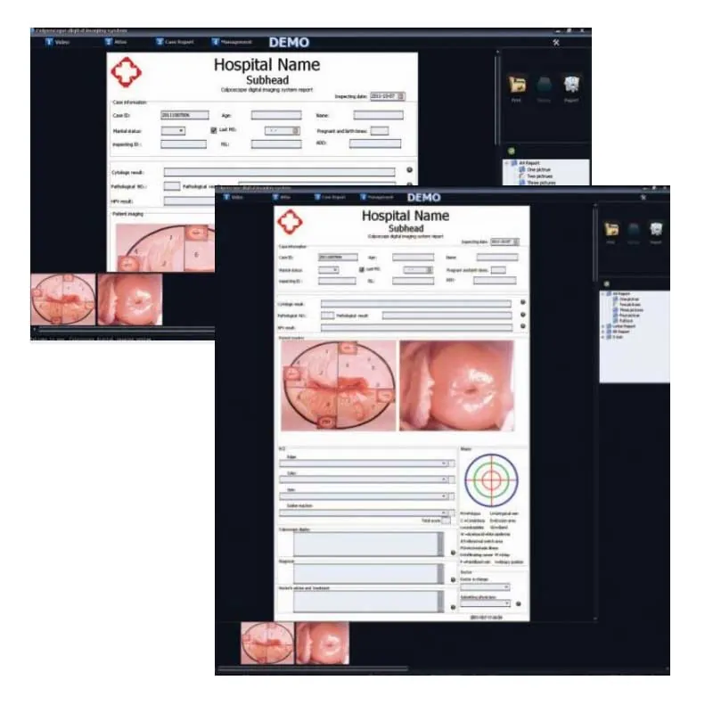Colposcopy Software + HDMI Capture Card